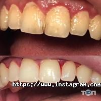 White Dent Одесса фото