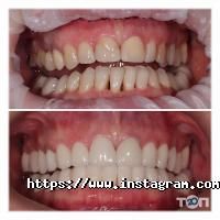 32 жемчужины Хмельницкий фото