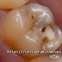Uni-Dent Астана фото