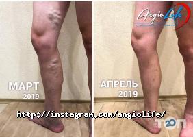 Приватні клініки AngioLife фото