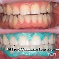 White Dent, стоматологічна клініка фото