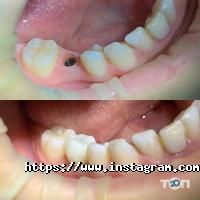 White Dent Одеса фото