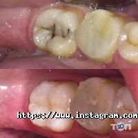 Стоматології White Dent фото