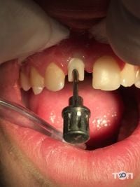 Art стоматологія доктора мосейко відгуки фото