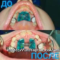 відгуки про Bolinet фото