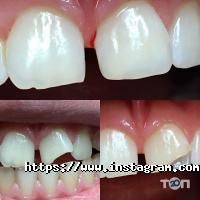 Стоматології Аюдент фото