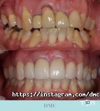 відгуки про Dmc фото