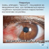 Офтальмологическое отделение ВОКБ Луцк фото