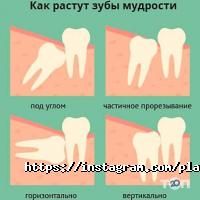 Стоматологии Platon фото