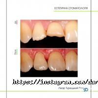 Дарлін Київ фото