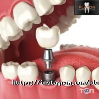 Platon, стоматологічний центр фото