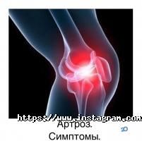 Південноукраїнський центр відновлення хребта Одеса фото