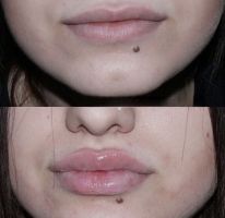 Вікторія Полякова Вінниця фото