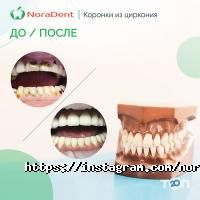 Nora Dent Київ фото