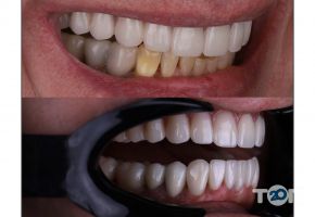 Dentistman відгуки фото