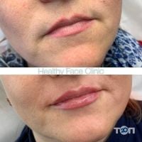 Салони краси, СПА Healthy Face Clinic фото