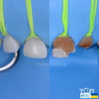ДентХаус, стоматологія - фото 8