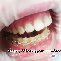 відгуки про Nora Dent фото