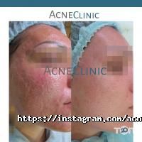 Косметологические клиники AcneClinic фото