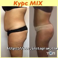 My Way, естетик-центр фото