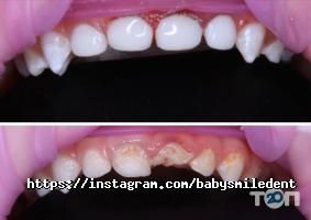 Baby Smile Київ фото