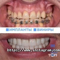 Illi Київ фото