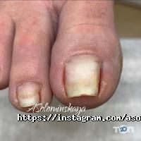 Подологічна практика Соломинської Анни фото