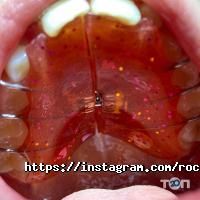відгуки про RocketSmile фото