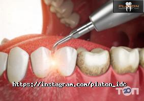 Platon відгуки фото