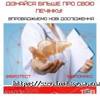 відгуки про Invivo фото