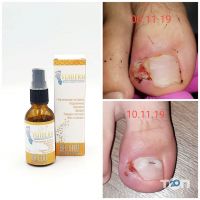 відгуки про VijiDerm фото