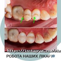 Стоматології Від А до Я фото