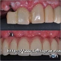 IQ Dentistry відгуки фото