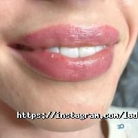 відгуки про LadySpace фото