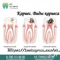 ST Clinic Астана фото