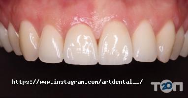 відгуки про Art Dental фото