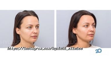 Institute Hyalual, клініка ін'єкційної косметології фото
