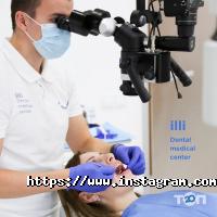 Illi відгуки фото