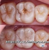 Стоматології Art Dental фото