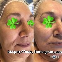 Clean Skin Ивано-Франковск фото