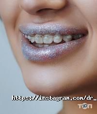 Go Smile відгуки фото