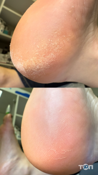 отзывы о Студия подологии и маникюра Вивчар Юлии фото