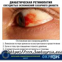 Окулюс Кропивницкий отзывы фото