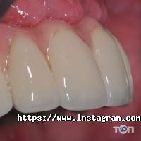 Стоматології IQ Dentistry фото