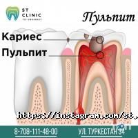 ST Clinic отзывы фото