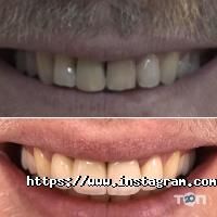Estetica, стоматологія - фото 9