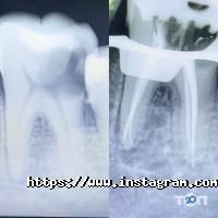 White Dent Одеса фото