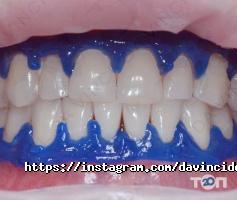 Стоматології Da Vinci Dental фото