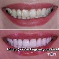 Стоматологии ABD Stoma-bis фото