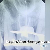 White Dent відгуки фото